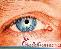 Slider image (3) PlacidWay Romania Medical Tourism